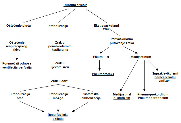 Patofiziološke sekvence kod barotraume pluća